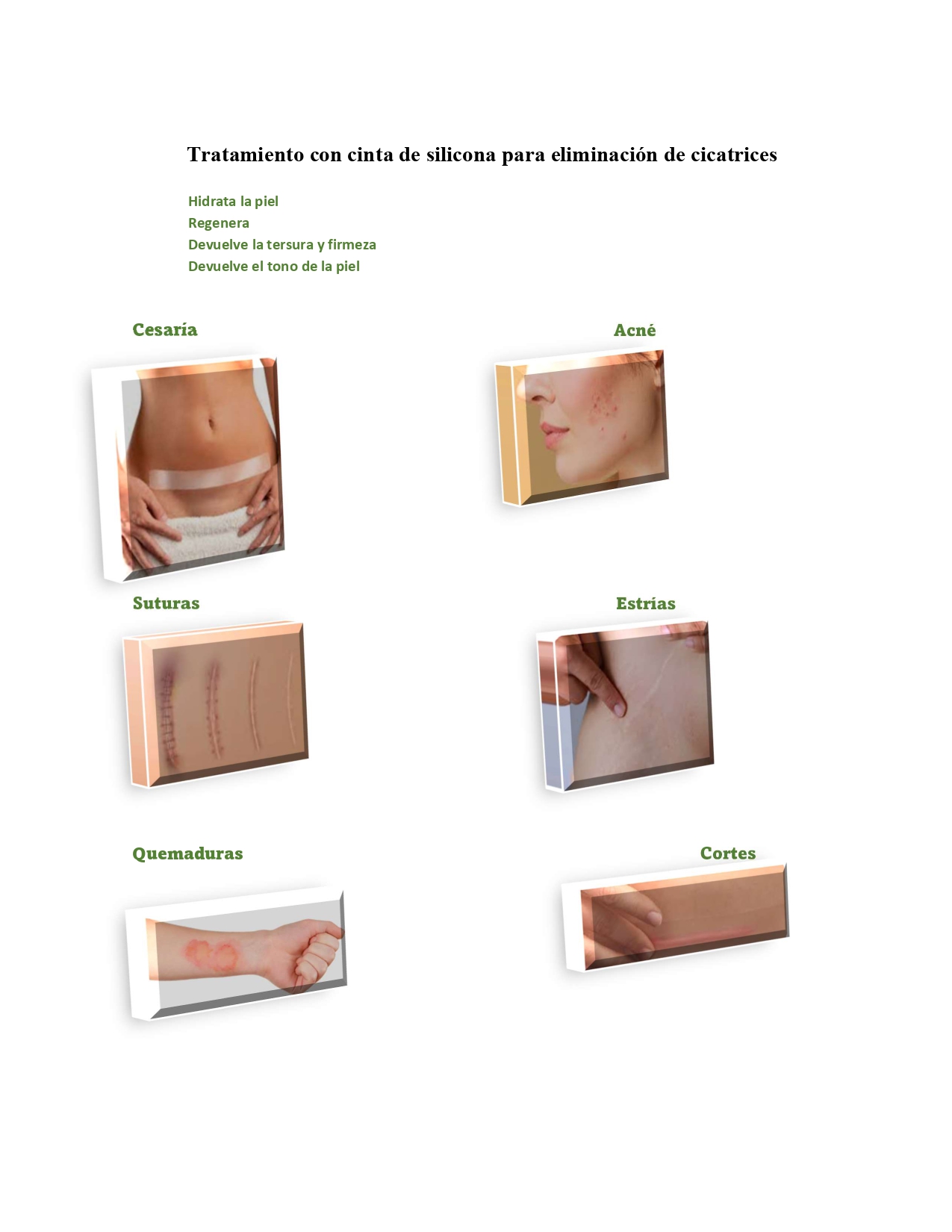 Cinta silicona transparente para cicatrices 3,5cm x 1.5mts - Imagen 2